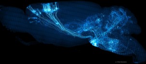 SagittalSEvenSmaller